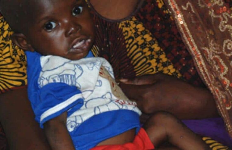 Malnutrition au Mali : enjeux et solutions pour protéger les enfants