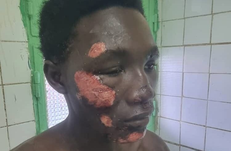Tchad : un père dénonce un échec sécuritaire après l&rsquo;agression près du camp 27