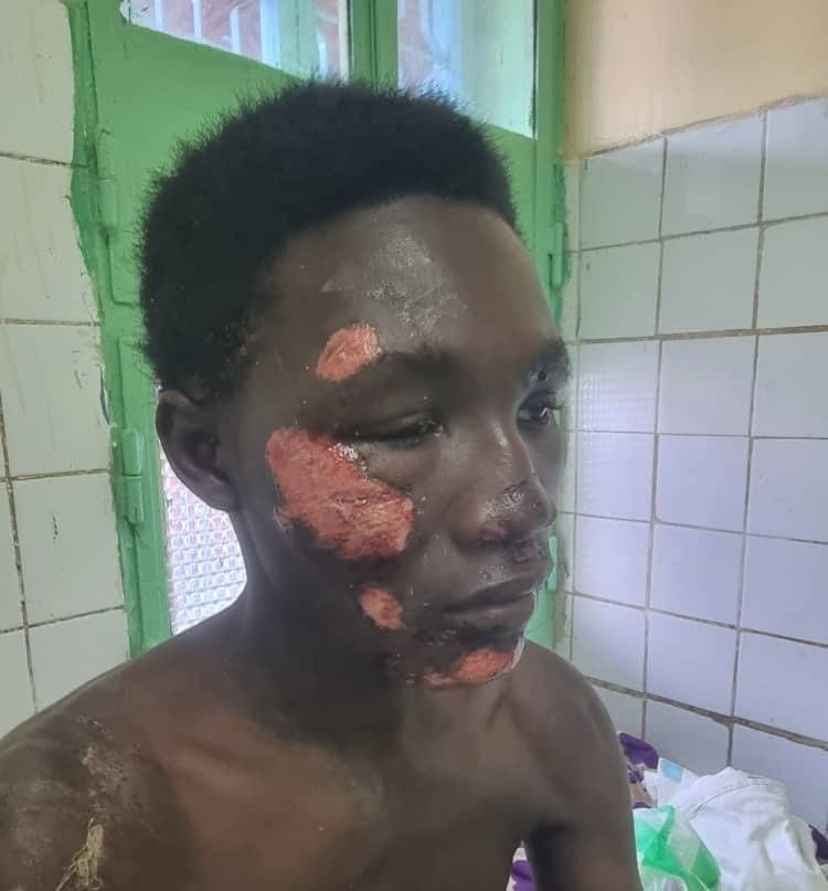 Tchad : un père dénonce un échec sécuritaire après l&rsquo;agression près du camp 27